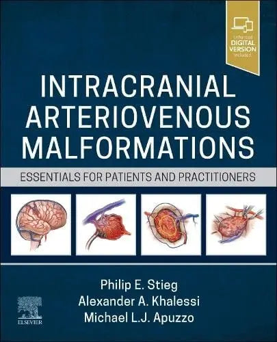 Intracranial Arteriovenous Malformations Essentials for Patients and Practitioners by Philip E. Stieg