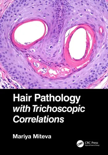 Hair Pathology with Trichoscopic Correlations CRC Press