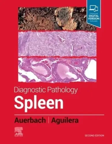 Diagnostic Pathology: Spleen Elsevier