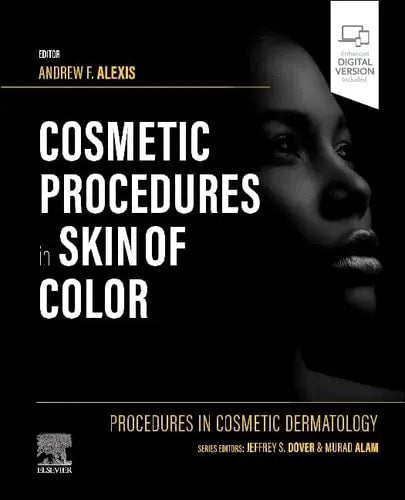 Procedures in Cosmetic Dermatology: Cosmetic Procedures in Skin of Color Elsevier