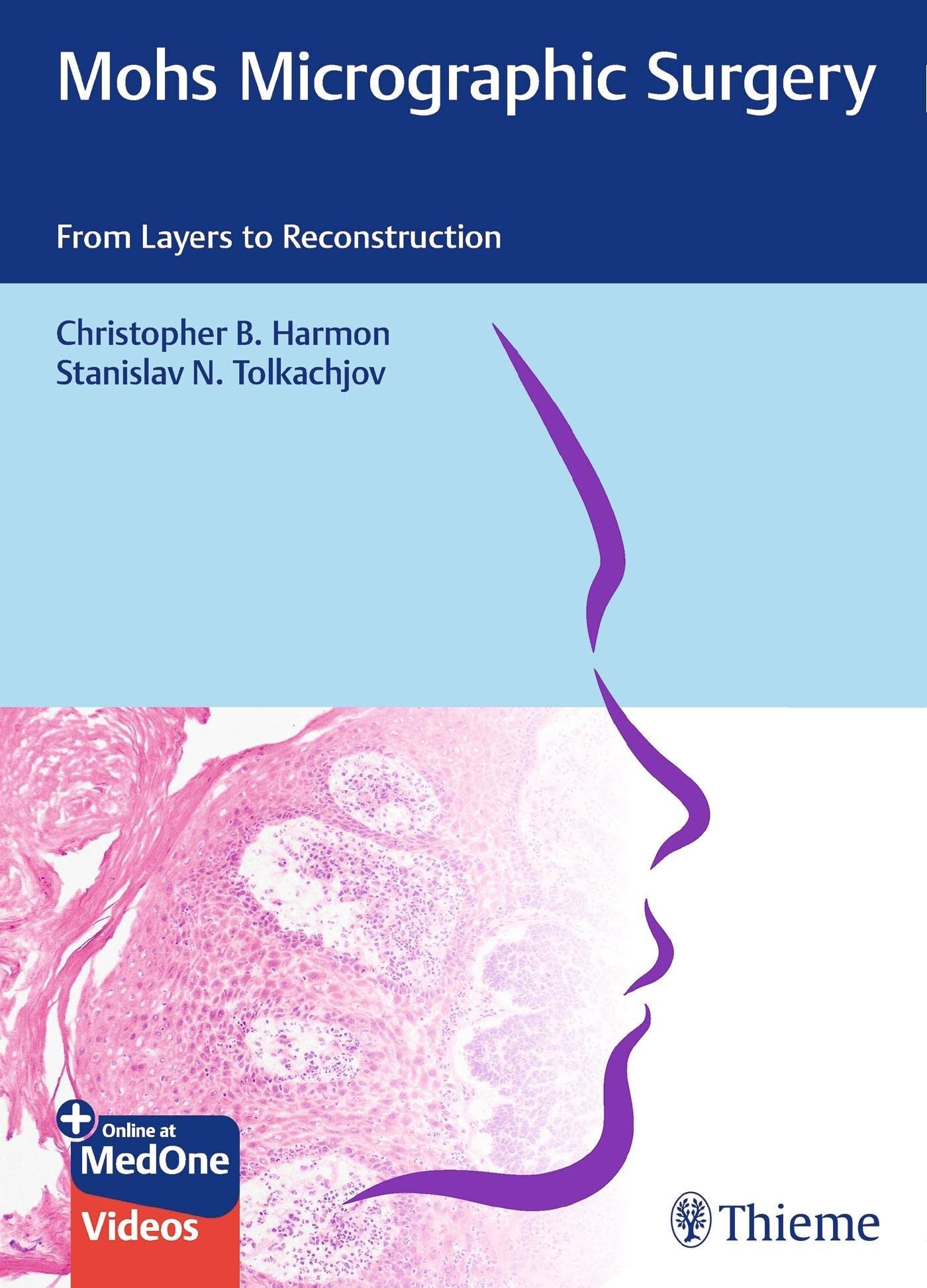 Mohs Micrographic Surgery From Layers to Reconstruction Thieme
