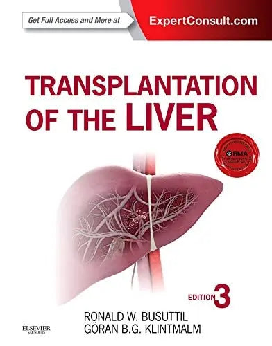 Transplantation of the Liver Elsevier - Health Sciences Division