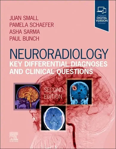 Neuroradiology: Key Differential Diagnoses and Clinical Questions Elsevier