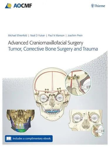 Advanced Craniomaxillofacial Surgery Tumor, Corrective Bone Surgery, and Trauma