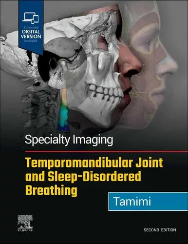 Specialty Imaging: Temporomandibular Joint and Sleep-Disordered Breathing Elsevier