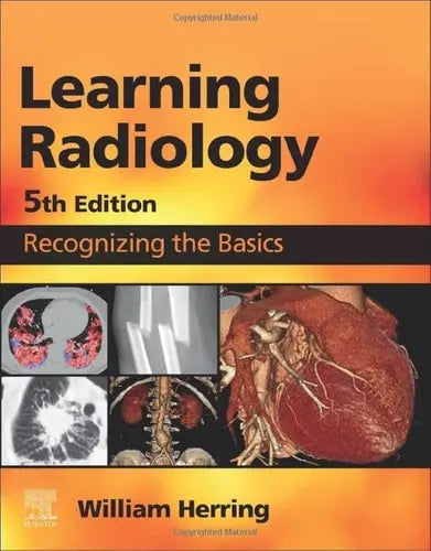 Learning Radiology Recognizing the Basics Elsevier