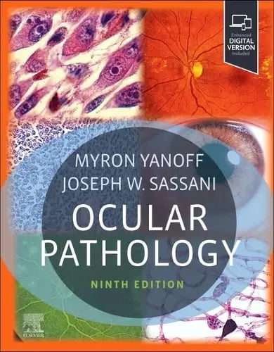 Ocular Pathology Elsevier