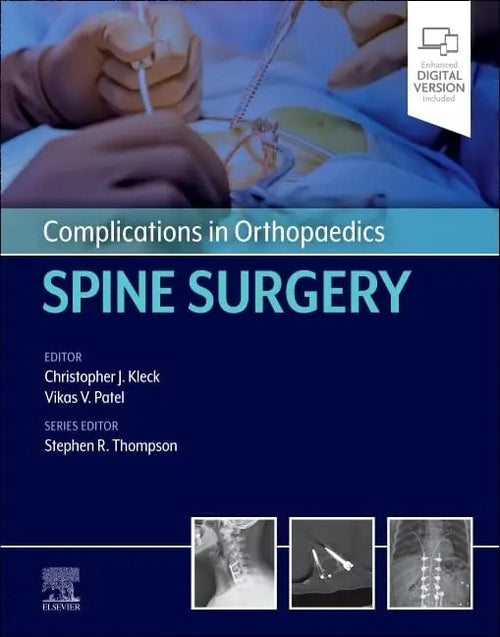 Complications in Orthopaedics: Spine Surgery by Vikas Patel