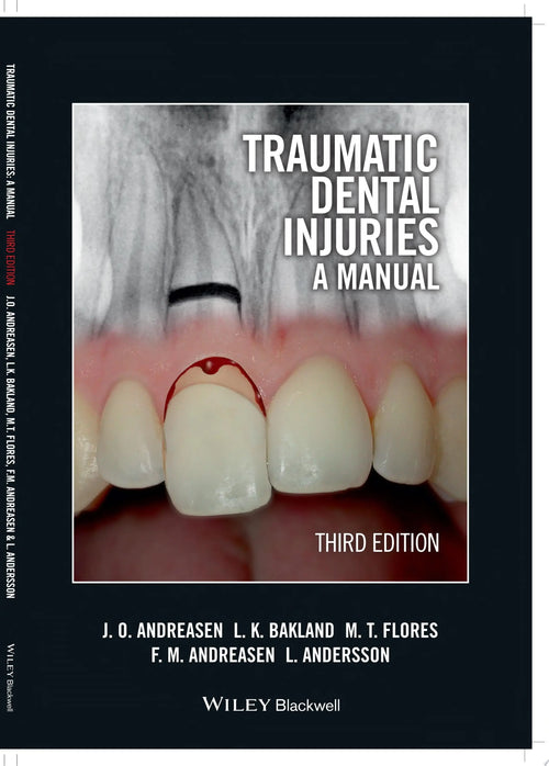 Traumatic Dental Injuries A Manual by Jens O. Andreasen