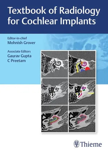 Textbook of Radiology for Cochlear Implants Thieme Medical Publishers