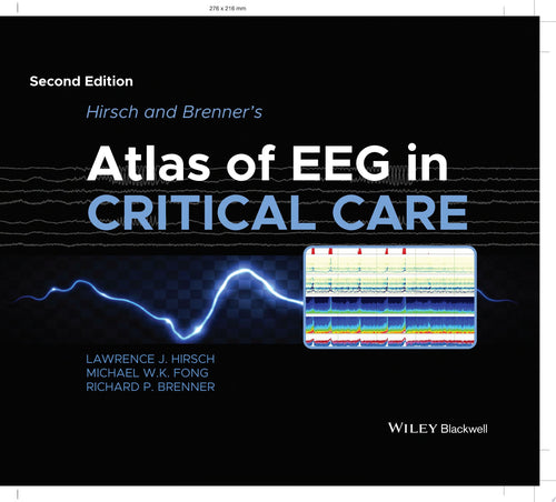 Hirsch and Brenner's Atlas of EEG in Critical Care