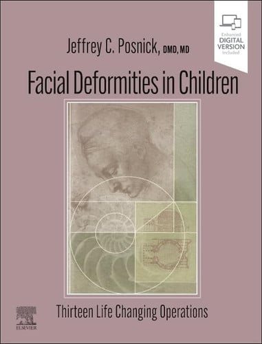 Facial Deformities in Children Thirteen Life Changing Operations by Jeffrey C. Posnick – book cover