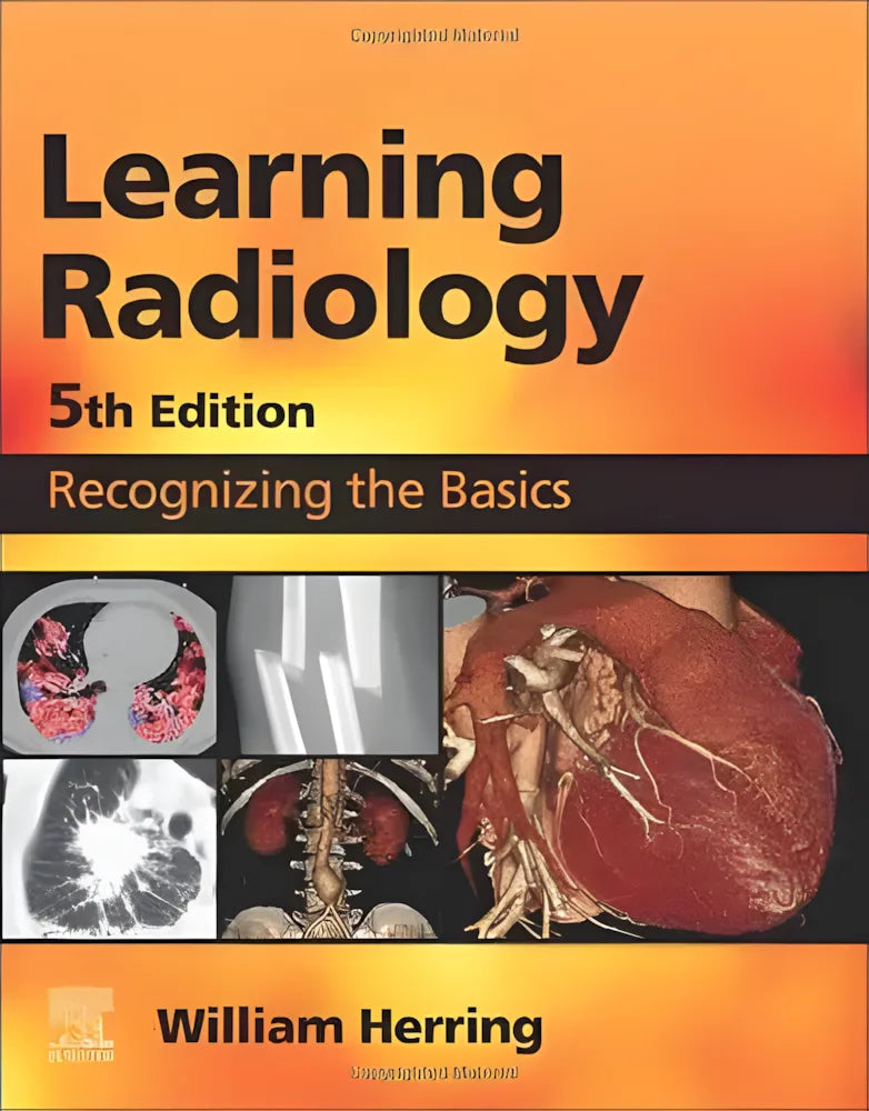 Learning Radiology: Recognizing the Basics – book cover