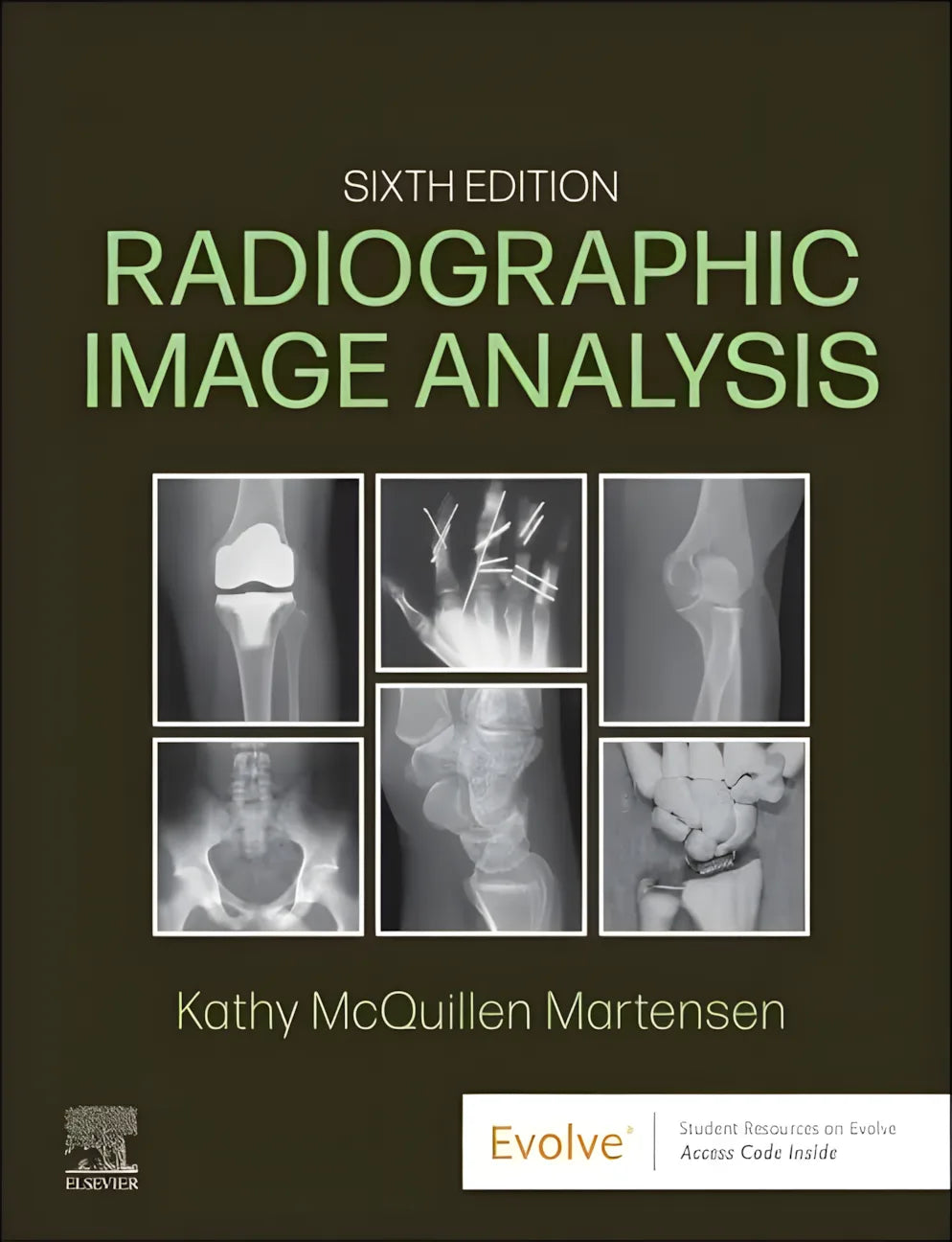 Radiographic Image Analysis – book cover