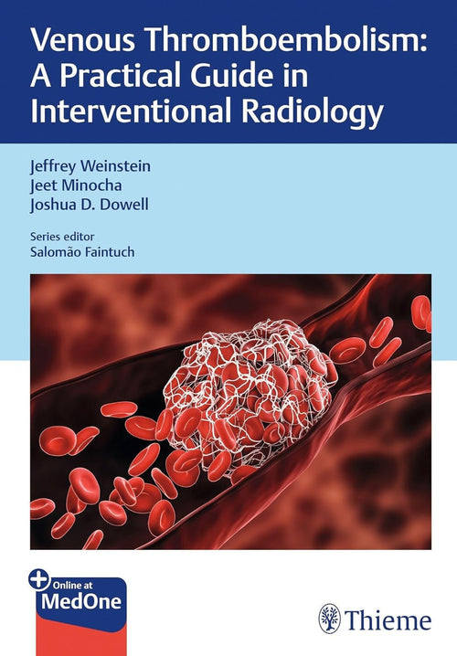 Venous Thromboembolism A Practical Guide in Interventional Radiology by Jeffrey Weinstein