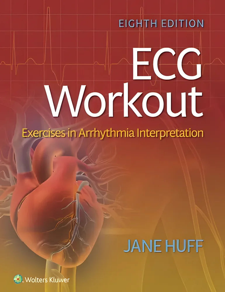 ECG Workout: Exercises in Arrhythmia Interpretation – book cover
