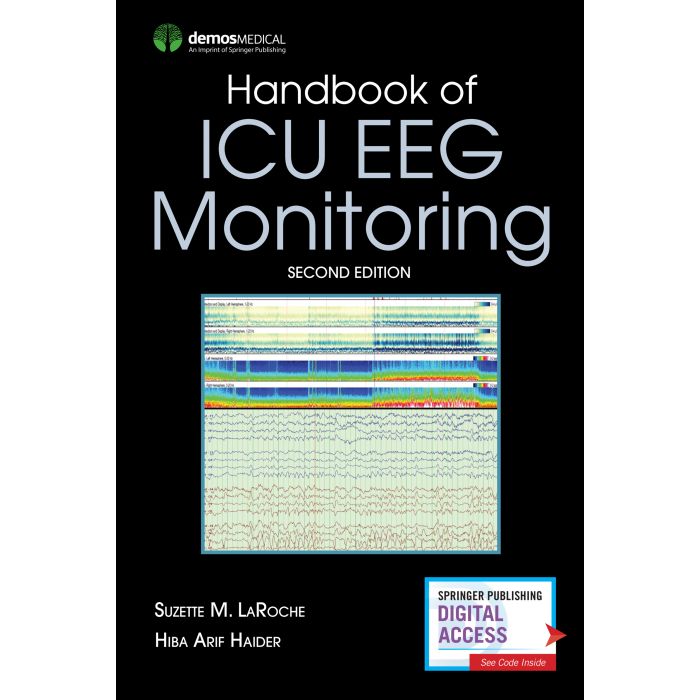 Handbook of ICU EEG Monitoring